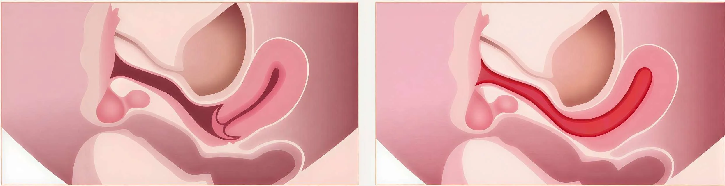 Mécanisme Avant/Après Rajeunissement